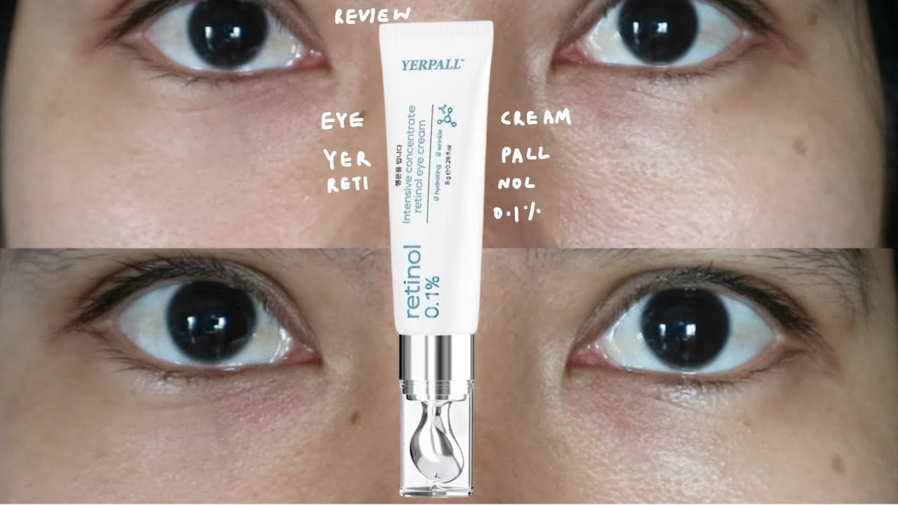 รีวิว eye cream yerpall intensive concentrate retinol ใช้แล้วเป็นไงบ้าง?
