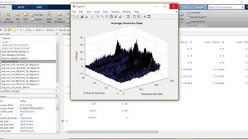 CLASSIFYING EEG SIGNAL USING SVM AND ELM CLASSIFIER