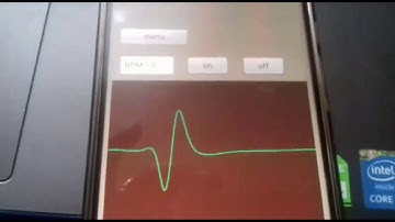 ECG using Operational Amplifiers and NI DAQ in LabVIEW with Bluetooth App