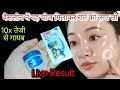 Vaseline Shampoo Remedy | Pigmentation, Daag Dhabbe Gayab 👩‍⚕️Doctor Bhi Hairaan 😱Vaseline Ka Ye Use