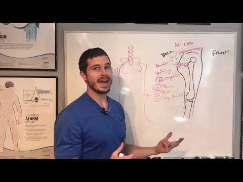 Video: Kan trochanteric bursitis ischias veroorzaken?