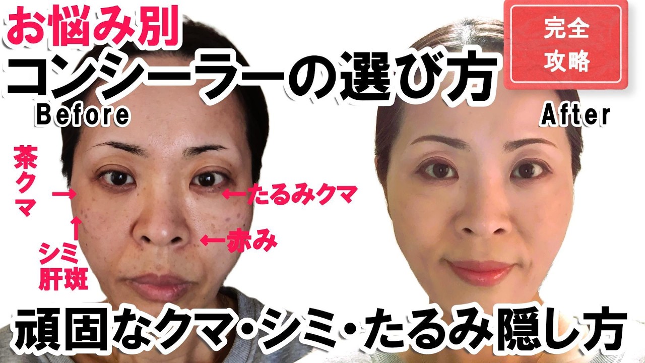 完全攻略】たるみクマ・青クマ・濃いシミの隠し方！まだコンシーラー
