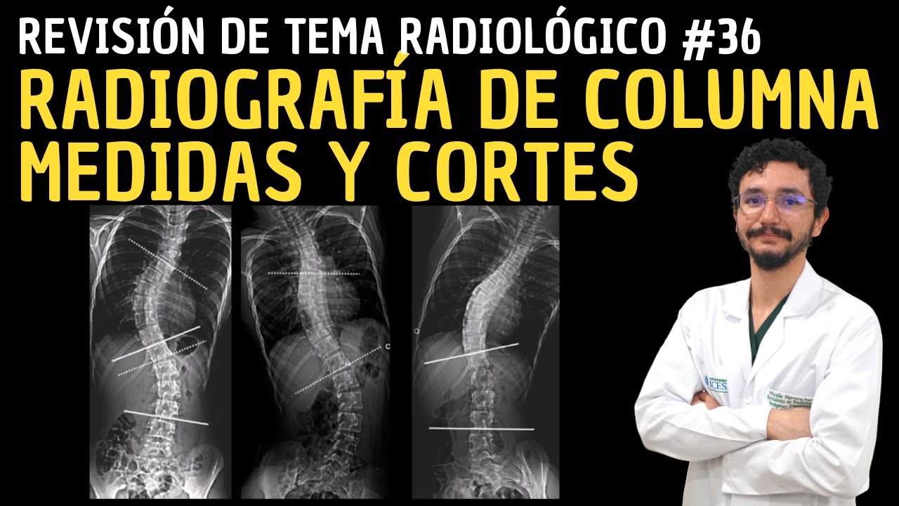 Radiografía de columna - medidas y cortes: Revisión de Tema Radiológico.