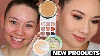 Testing NEW Products on ACNE!