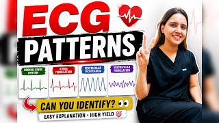 ECG Patterns You MUST Know! ❤️ | Easy ECG Interpretation