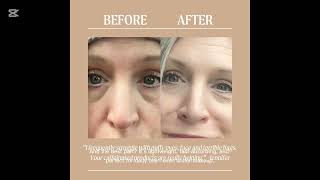 UpCircle Eye Cream Review – Does Coffee Really Remove Dark Circles &amp; Puffiness?