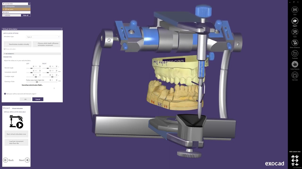 exocad Virtual Articulator Module
