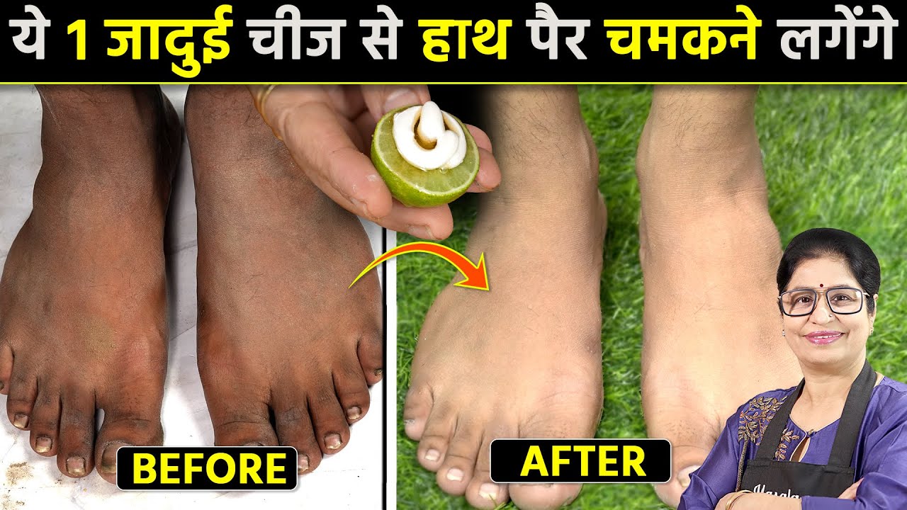 दुनिया का सबसे आसान तरीका जो हाथ पैर गर्दन को चमका देगा, 1 ही बार में 100% Result | Feet Brightening