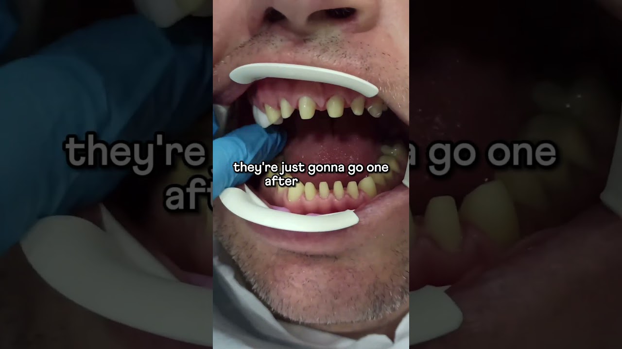 Problems with overseas dental treatment!