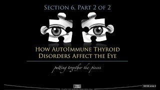 How Thyroid Eye Disease Affects the Eyes - Part 2