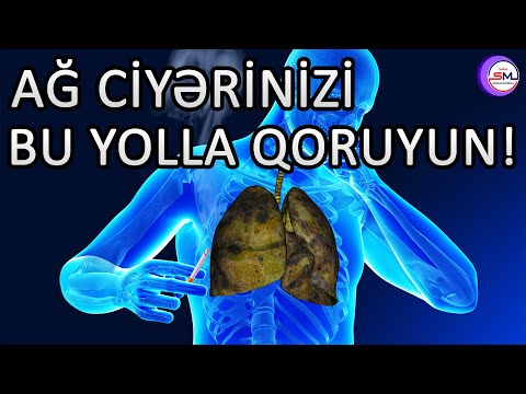 Video: İşçi üçün ağ kart lazımdır?