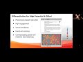 Amplify Science Curriculum Insights