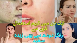 Potato Homemade Cream For Dull Acne ,Pimples ,Spotless,Melasma Hyperpigmentation Skin|rahilaarslan