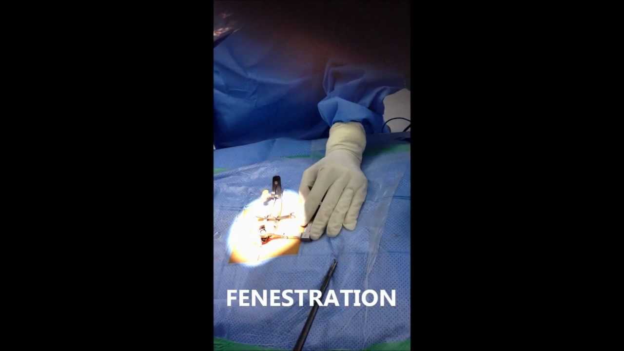 mico disk surgery camera iphone 8 plus apk