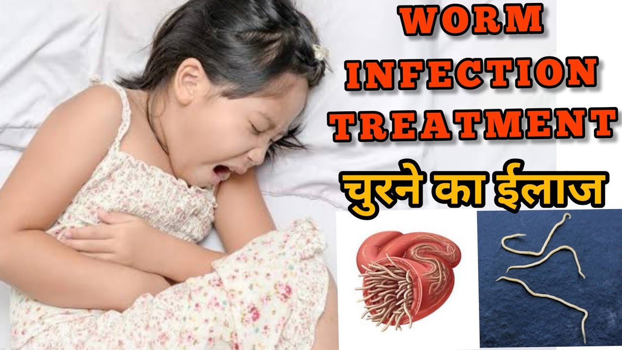 Worm Infection Treatment For Baby In Hindi Symptoms Churne Ka Desi