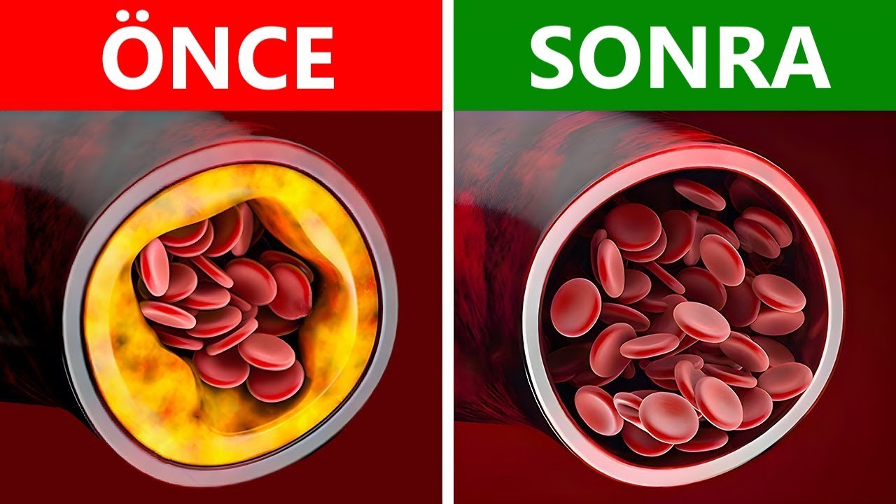 Damarlarınızı Temizleyen En İyi Yiyecekler | Dr.Berg Türkçe