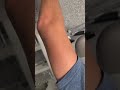 STRENGTH: Prone T