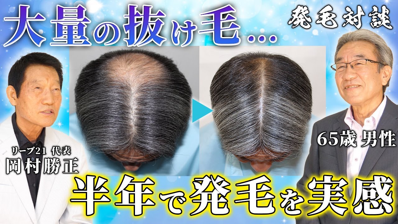 Serious Hair Growth Dialogue 01: Mr. Seta (65-year-old male