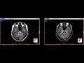 【医学部保健学科】人体のCTやMRIの画像を見てみよう！