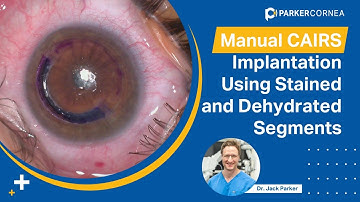 Manual CAIRS Implantation Using Stained and Dehydrated Segments