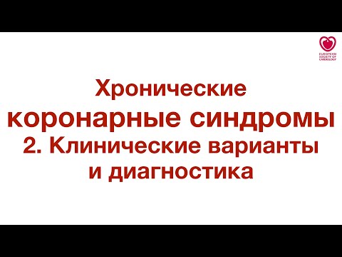 Главное в диагностике хронических коронарных синдромов