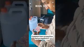 WIDAL TEST By slide method #lab #shortvideo #trending #viral #trendingshorts #widaltest