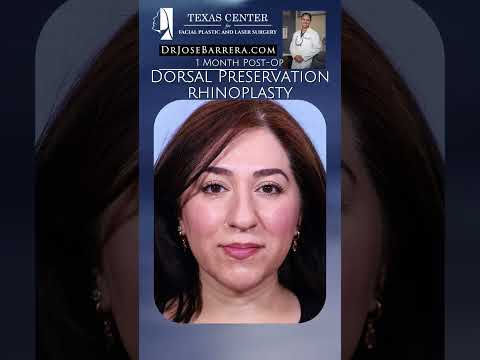 Video thumbnail: ✨ 1 Month Post-Op | Dorsal Preservation Rhinoplasty ✨ · Dr. Jose Barrera
