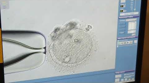 Fertilizing an Egg with Sperm in the Lab - ICSI Footage