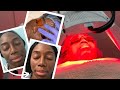 TREAT HYPERPIGMENTATION AND ACNE WITH FACIALS