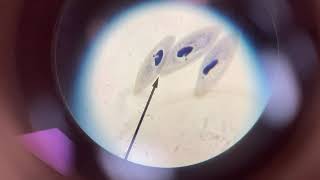 Lab Protists Fungi Video
