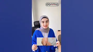 كيف نميز حبوب التحسس حبوب الوجه حبوب طب بشره صحيه بشرة دهنية جمال بشرة جميلة حب شباب 