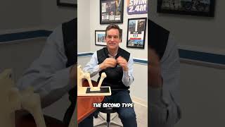 The Difference Between Anatomic and Reverse Shoulder Replacement