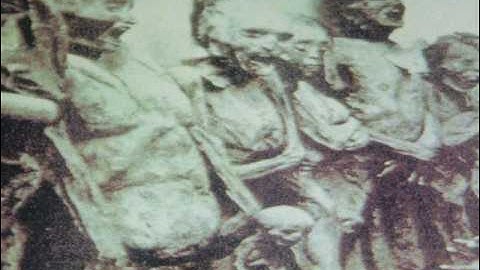 Atom Infant Incubator - Praenatal Segment