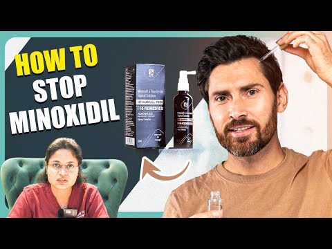 How to Stop Minoxidil Safely? 🤔 | Tips to Prevent Hair Fall | New Roots