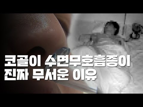 코골이·수면무호흡증 방치하면 심장병 부른다 / YTN