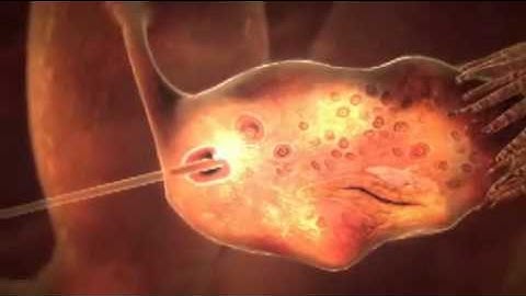 3D animation of how IVF works