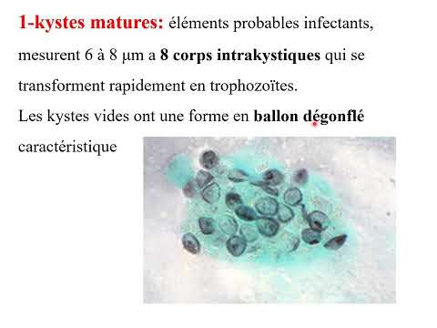 Cryptococcose, Pneumocystose, Microsporidiose