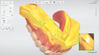3Shape TRIOS Edentulous patient    Copy denture scanning workflow