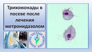 Трихомонады в посеве после лечения метронидазолом