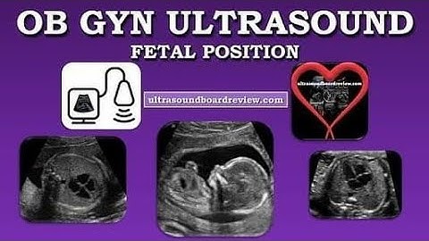 How To Determine Fetal Presentation and Fetal Situs Ultrasound