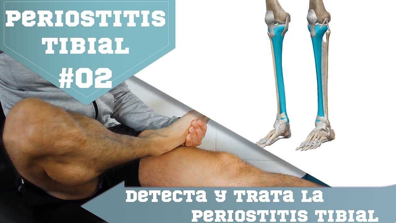 Qué es la Periostitis tibial y cómo tratar esta lesión YouTube