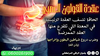 رقية قوية جدااا لإبطال عقد القولون والمعدة وإخراج سحر البطون..رضوان الراقي..0600261900..0666778582