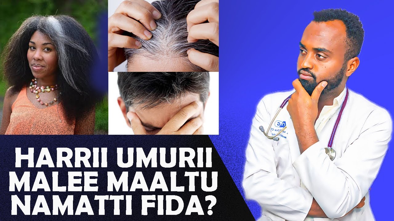 Aarrii Rifeensaa  (ሽበት) Maaltu dafee namatti fida? Akkamitti ofirraa ittisna