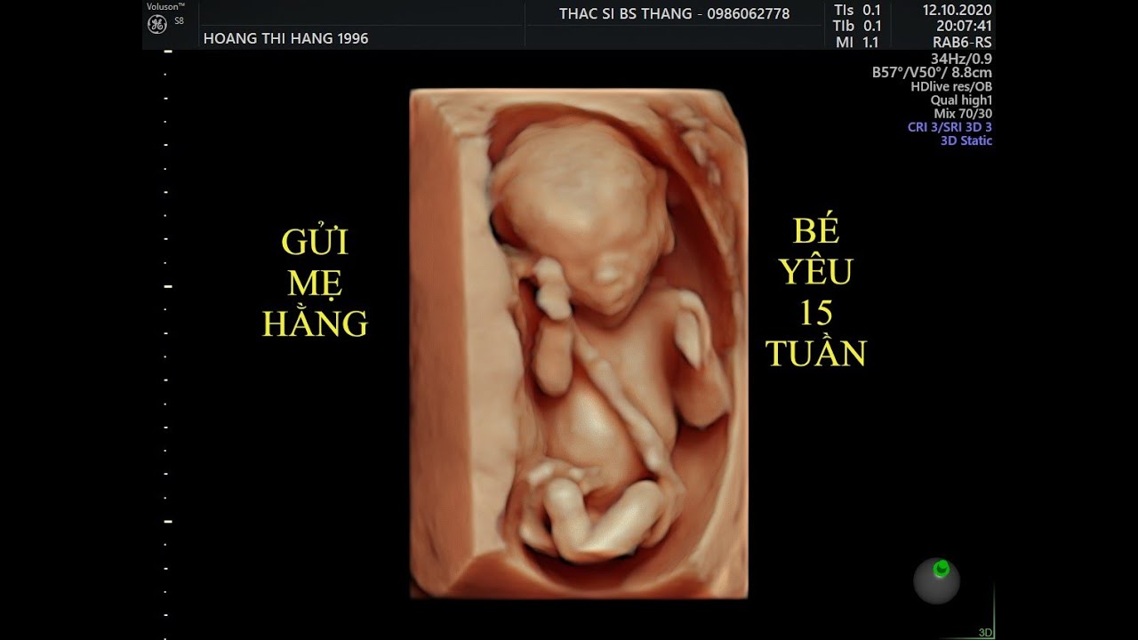 THAI 15 TUẦN - TẠO DÁNG ĐÁNG YÊU!