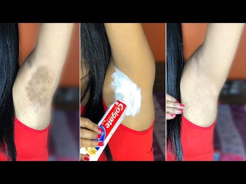 IN 5 MINUTES LIGHTENING DARK UNDERARM WITH COLGATE TOOTHPASTE