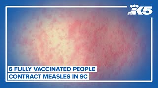 6 Y Vaccinated People Infected With Measles In South Carolina Outbreak