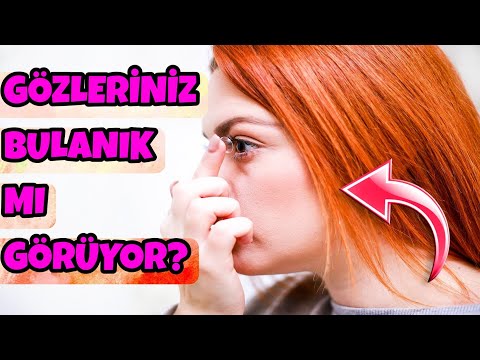 Astigmat nedir? Astigmat Nasıl Geçer? Astigmat Belirtileri ve Astigmat Tedavisi !