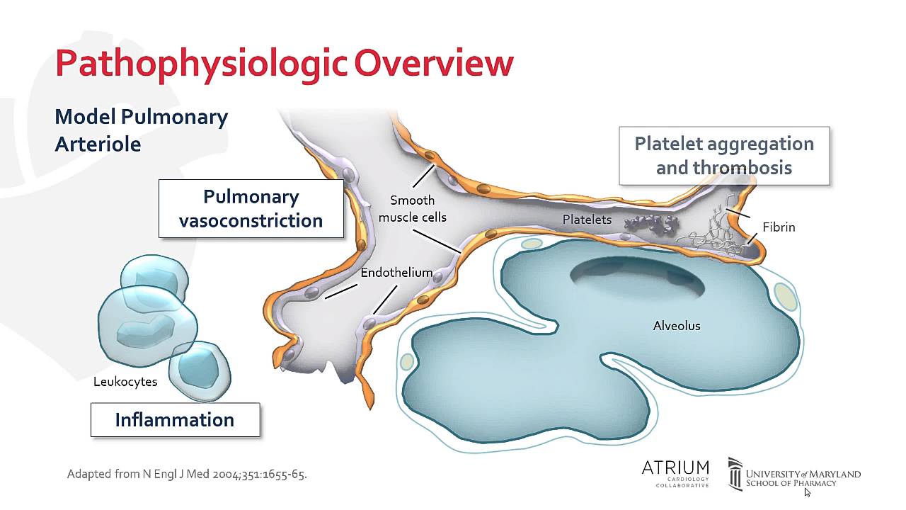 arterial hypertension pathogenesis)