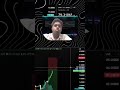 90% Traders Miss This in Silver 😱 | XAGUSD Trade Breakdown