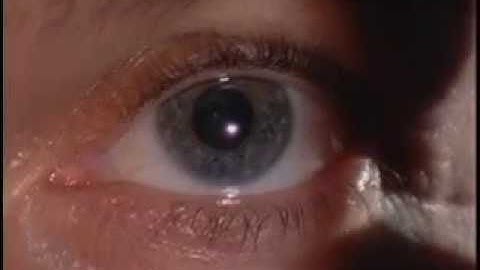 Blindsight: Seeing Without Awareness